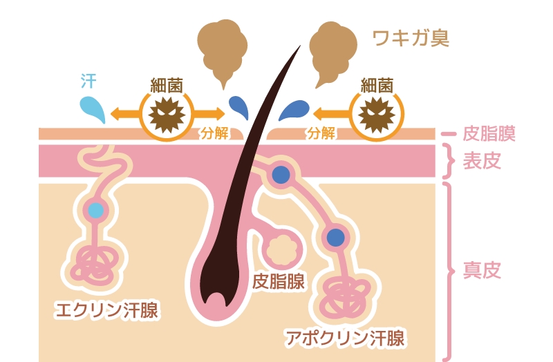 ワキガの原因