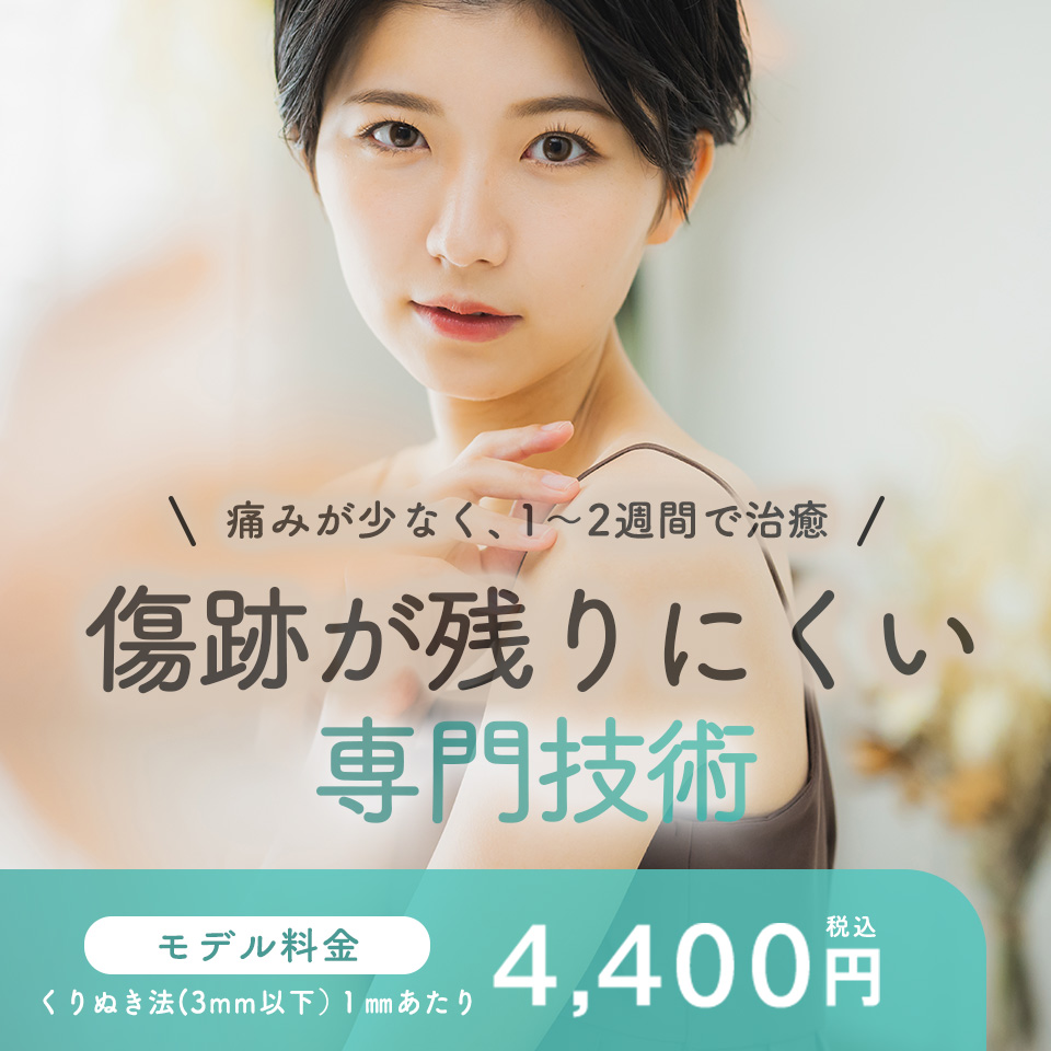 ほくろ・イボ