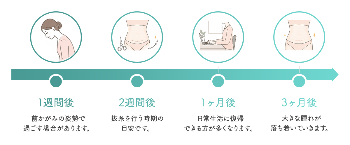 ダウンタイムの経過
