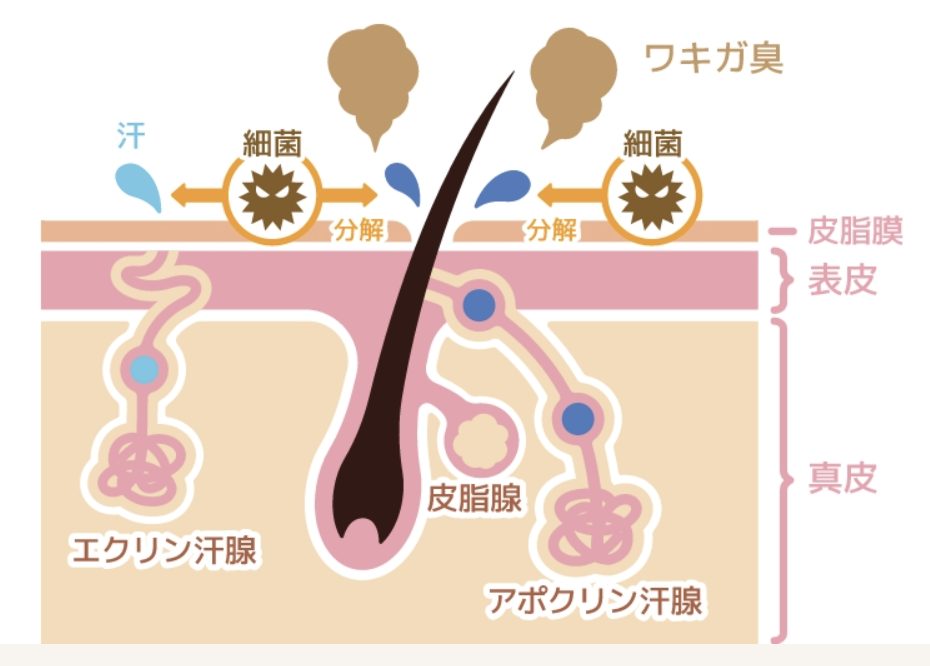 ワキガの原因
