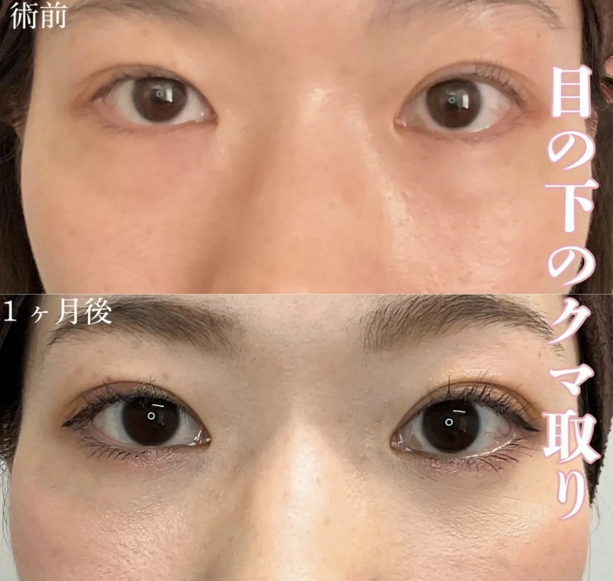 症例