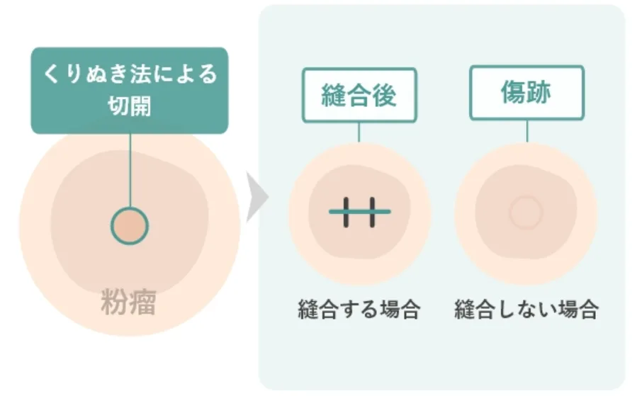 くり抜き方