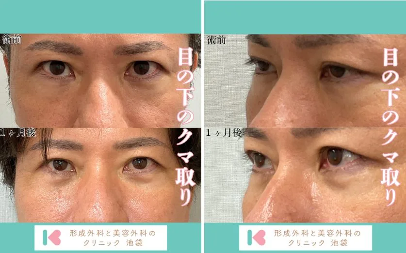 池袋　症例写真