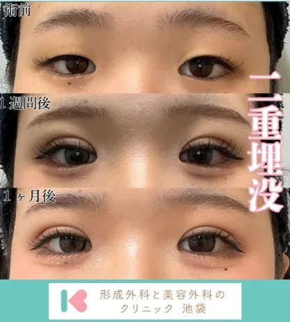 症例写真