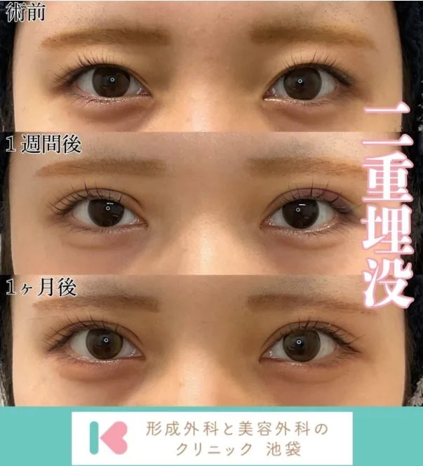 症例写真