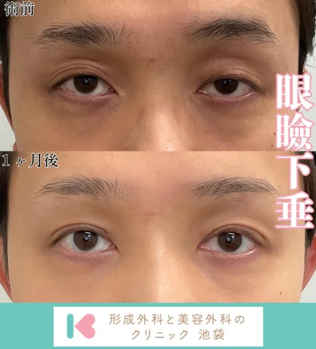 症例写真
