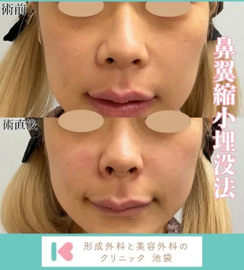 症例写真