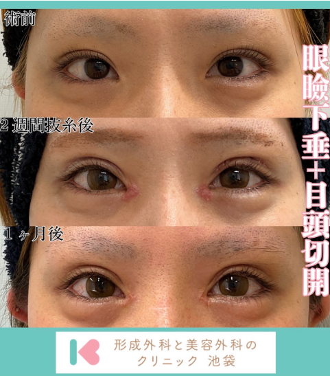 症例写真