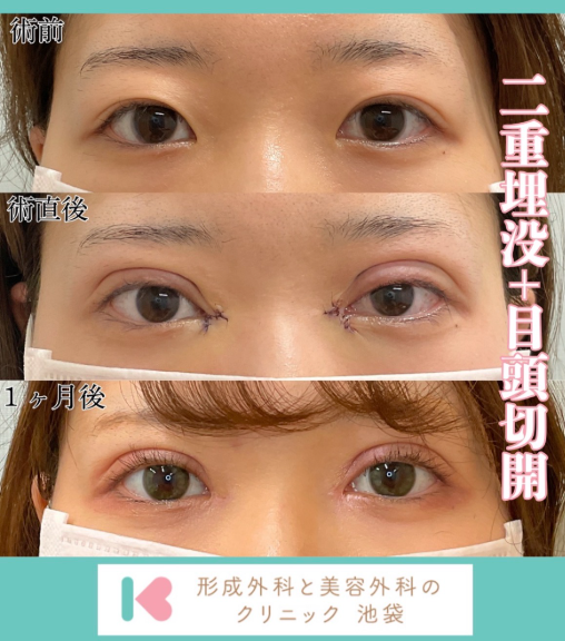 症例写真